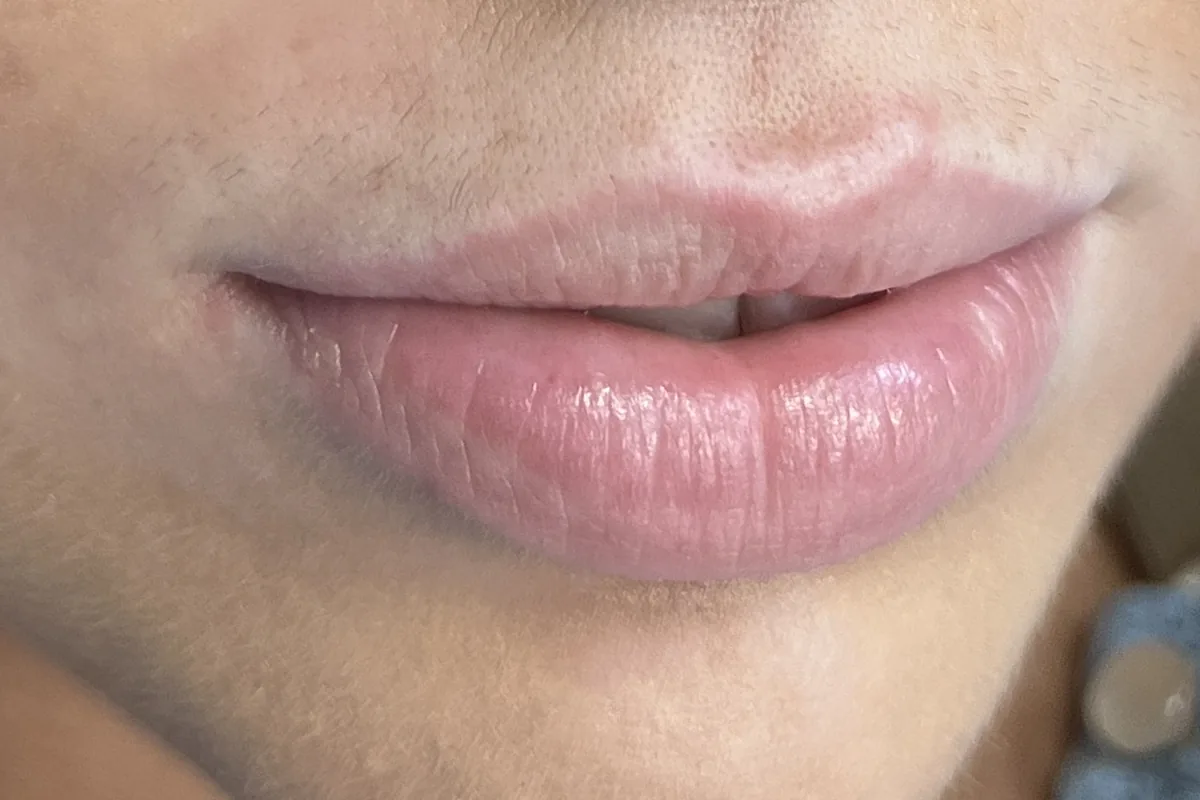 A guest's natural lips before lip blushing at Aloha Beauty Lounge South Jordan